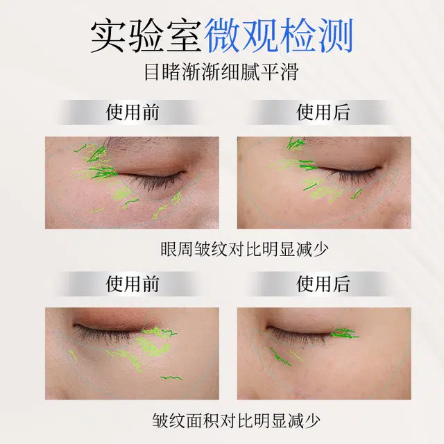 TJE 377+577 12ml24ml48ml