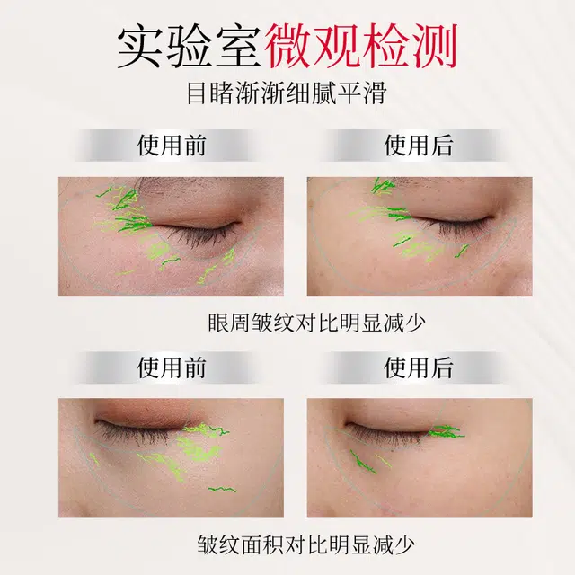 TJE 377+577 12ml24ml48ml