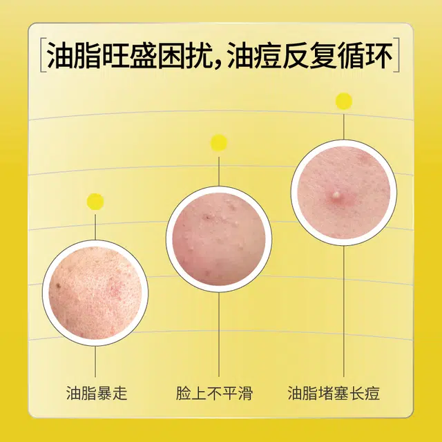 羽素 安肌调理平衡水清痘火 保湿舒缓控油