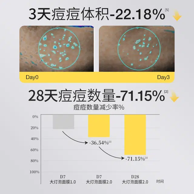 羽素 安修祛痘面膜 舒红瘪痘 控油收缩毛孔 男女学生党