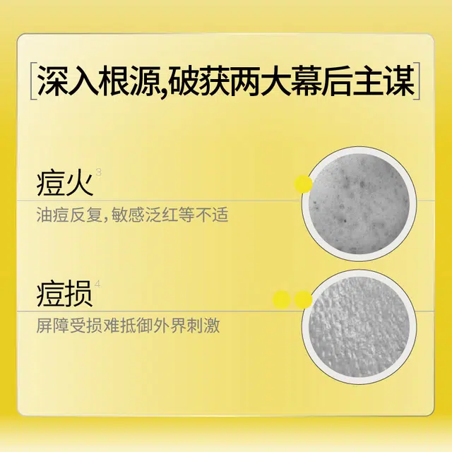羽素 安肌修护平衡乳 修痘损 保湿控油祛痘舒缓
