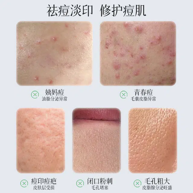 30ml