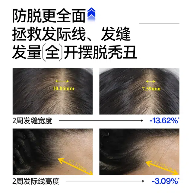 EHD 500ml500*2