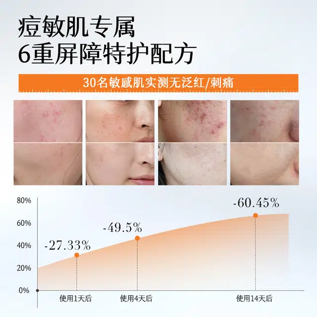 初夏堂初夏堂胶态硫祛痘精华液 保湿滋润舒缓补水
