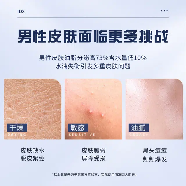 IDX