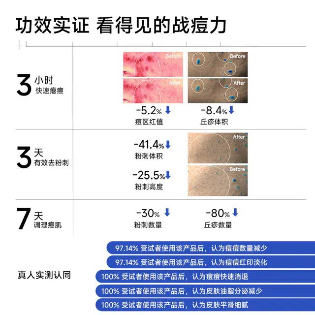 阳菲净颜祛痘精华液 保湿去角质