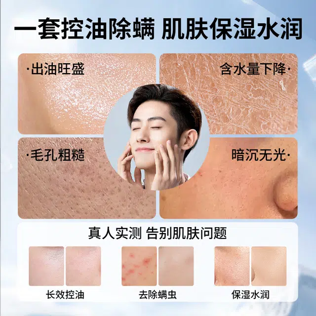 米云 恋爱仪式感平价男士护肤套装礼盒两件套/三件套 控油祛痘除螨深层清洁补水保湿 控油洗面奶+保湿水+精华乳+面膜