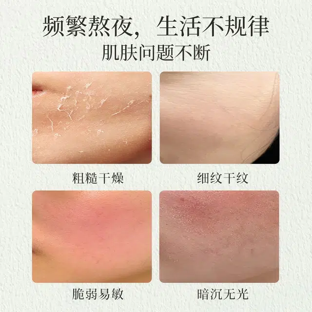 瑷露德玛睡眠面膜 保湿舒缓 免洗 中性肤质多种肤质油性肤质混合型肤质