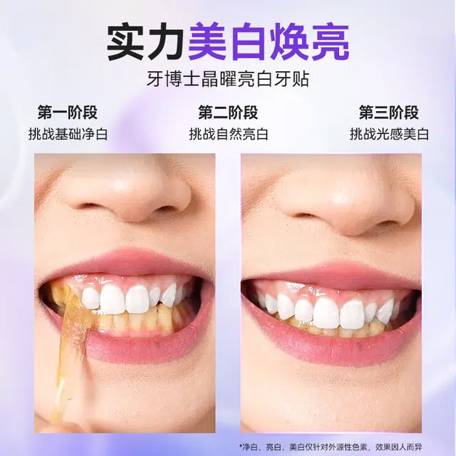 牙博士 牙本质修复抗敏美白牙膏牙贴 清洁美白