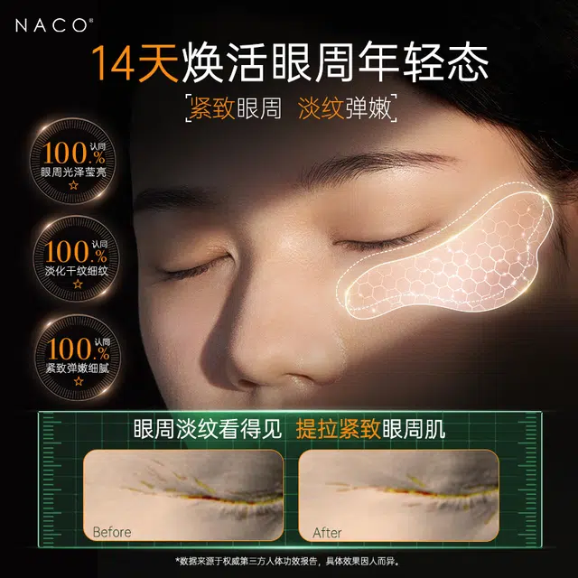 NACO 1020