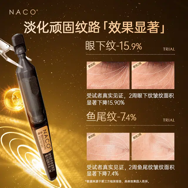 NACO V30