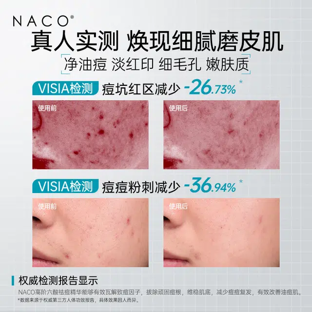 NACO 30
