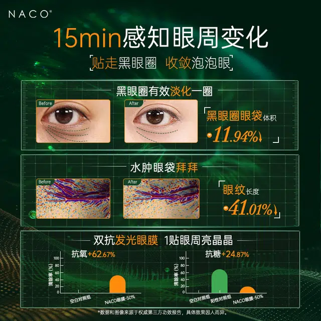 NACO 1020