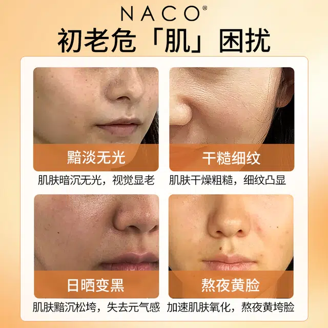 NACO 28