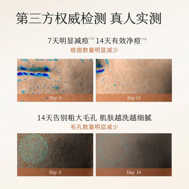 300g