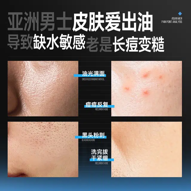 左颜右色 清肌祛痘洗面奶男控油水杨酸 微酸洁面乳 去黑头收缩毛孔淡痘印清洁清爽 男款 素颜霜/精华液护肤品套装