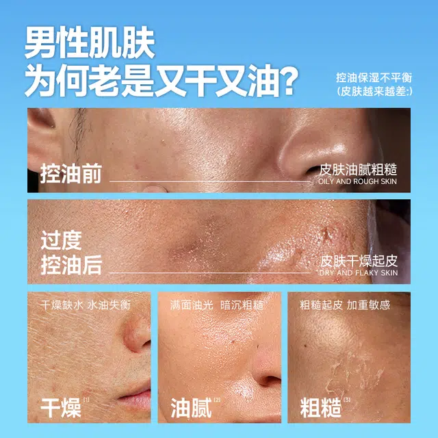 左颜右色 微酸净肤 男士护肤套装 深层清洁祛痘补水滋润控油清爽去黑头 洗面奶+爽肤水+乳液
