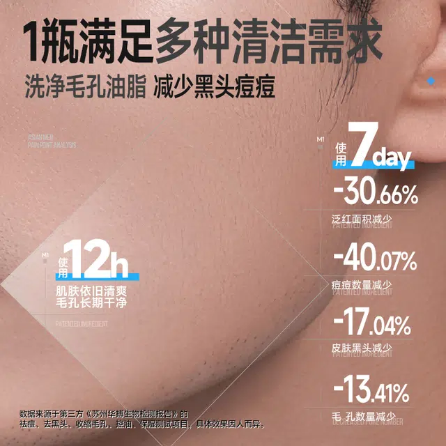 20g+150g+*1+*5