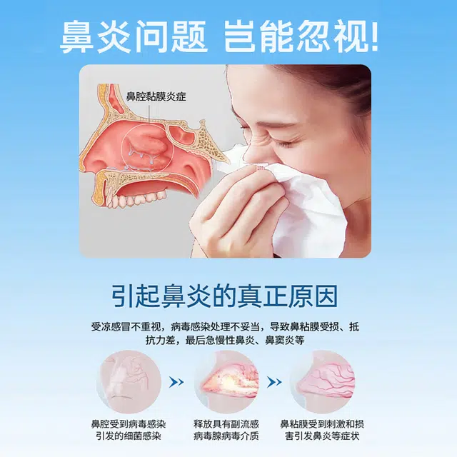 内廷上用 医用过敏鼻炎凝胶鼻腔护理 打喷嚏鼻粘膜感染鼻粘膜充血
