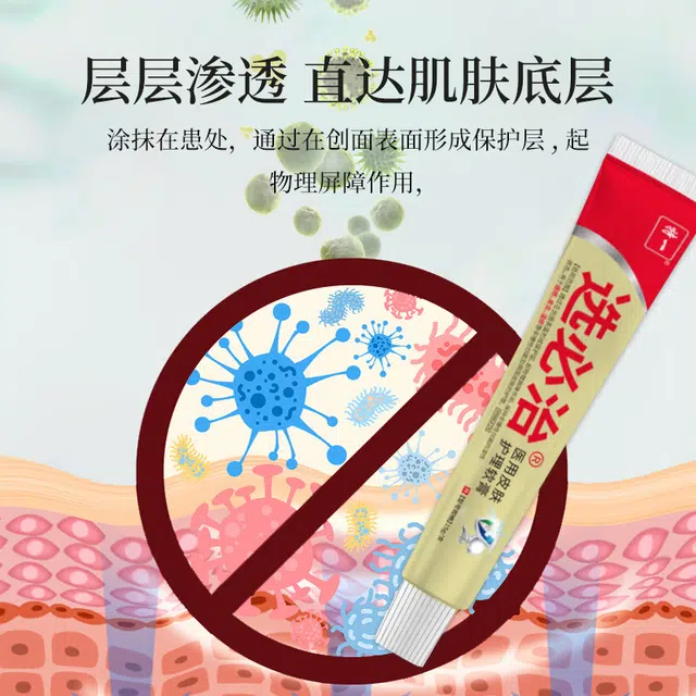 特一 选必治皮肤护理软膏 痤疮皮炎湿疹痘痘止痒过敏红点