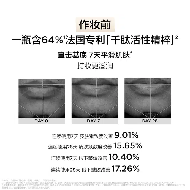 10ml