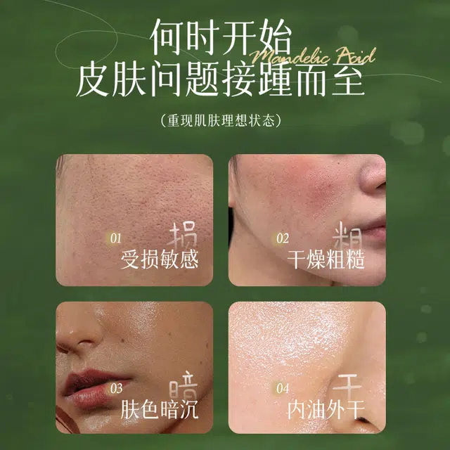 歌宝莲杏仁酸焕肤精华液 淡纹抗糖舒缓维稳提亮紧致保湿滋润清爽修护补水 多种肤质