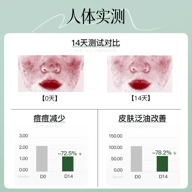 妮雅丝 益生菌水乳套装 控油祛痘肌抗痘控油祛痘水油平衡 舒缓提亮修护