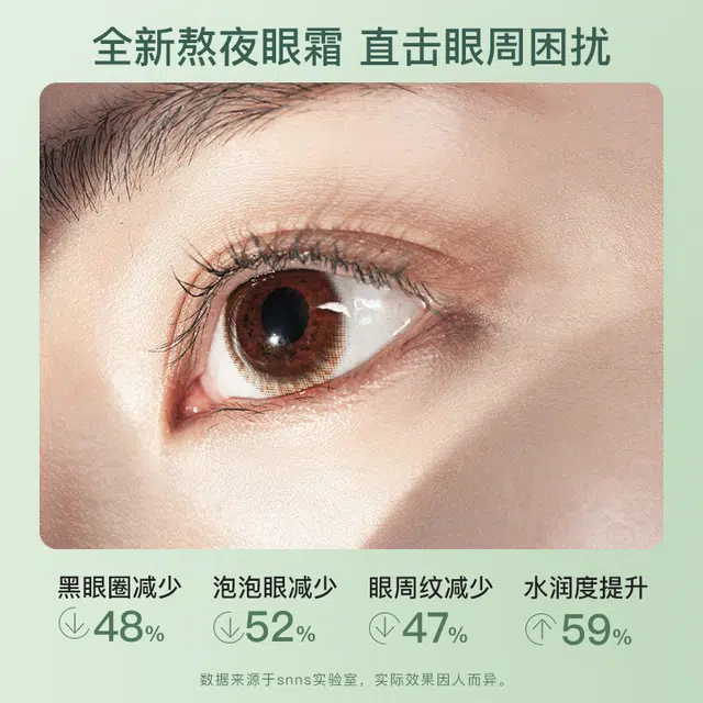 SNNS 20g20g