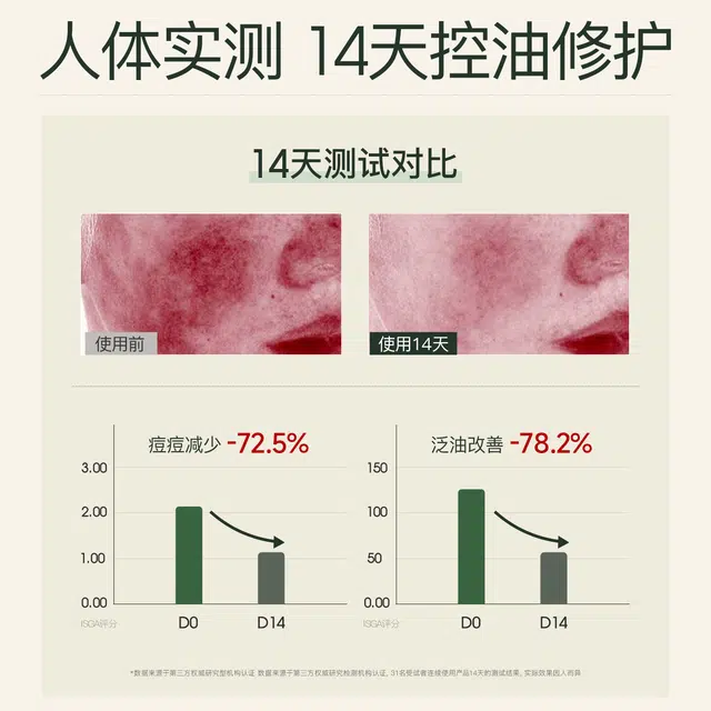 妮雅丝 益生菌水乳套装 控油祛痘肌抗痘控油祛痘水油平衡 舒缓提亮修护