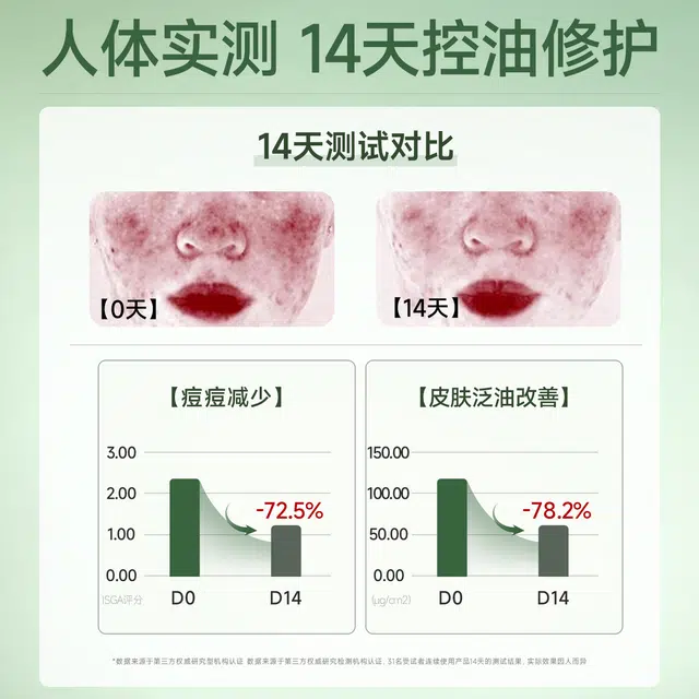 妮雅丝 益生菌控油祛痘护肤套装 保湿