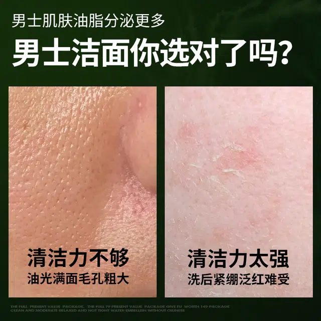 百雀羚 控油净透温和清洁氨基酸洁面乳  祛痘舒缓敏感改善出油