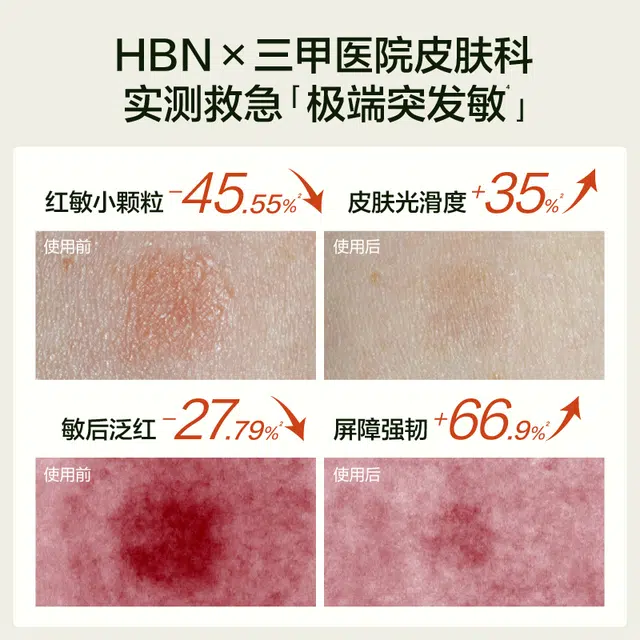 HBN 3.0 50g