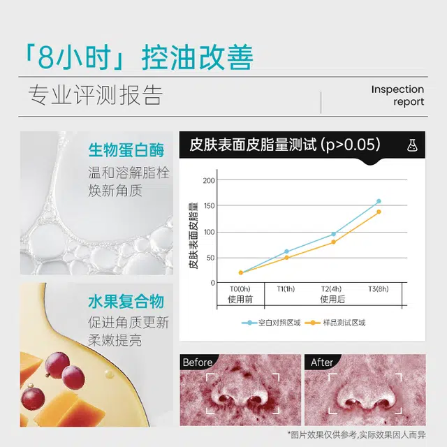 ILSO 150ml+