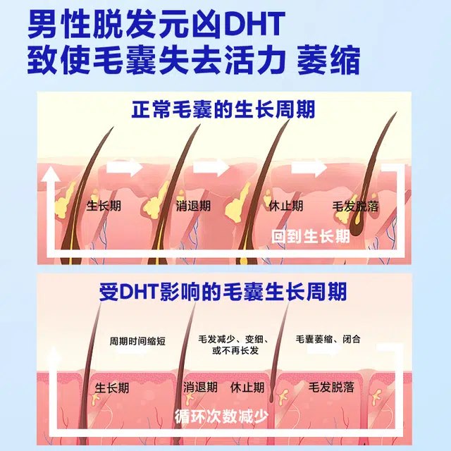 70ml
