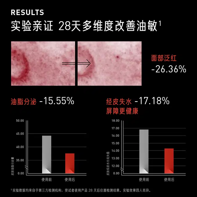 15ml30ml