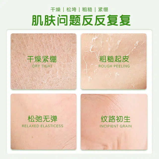 植祛 爽肤水乳组合 保湿补水