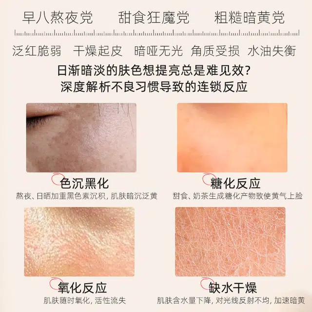 雪玲妃 美少女舒护娇颜水乳减黄提亮 保湿