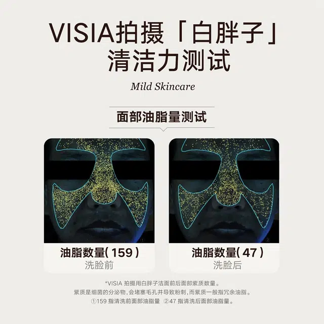 5 1+3+3+5+1