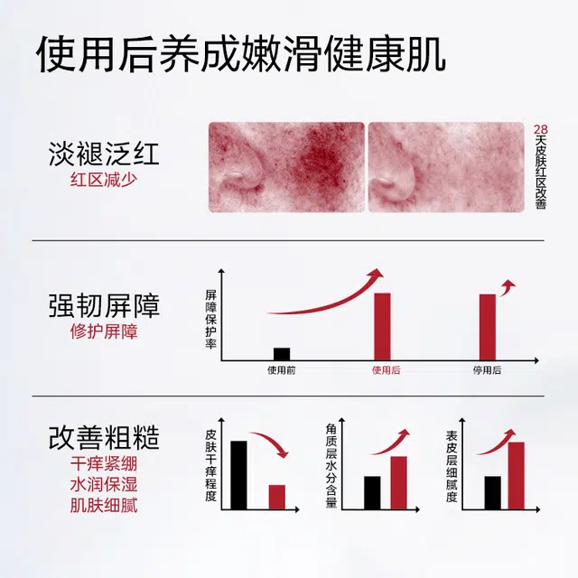 优理氏酵母修护维稳精华油精华液 保湿滋润舒缓 保护肌肤屏障