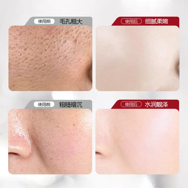 宝薇泉  烟酰胺凝胶改善面部肤色暗沉细致毛孔黄黑皮保湿霜面霜 淡痘印淡纹滋润祛痘 中性肌干皮油皮混合肌