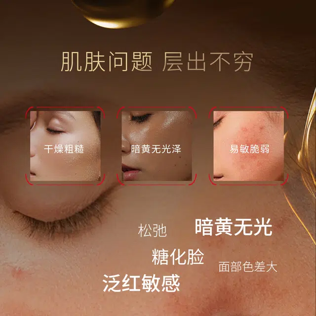 圣珂兰金纯系列柔光安肤精华油 舒缓