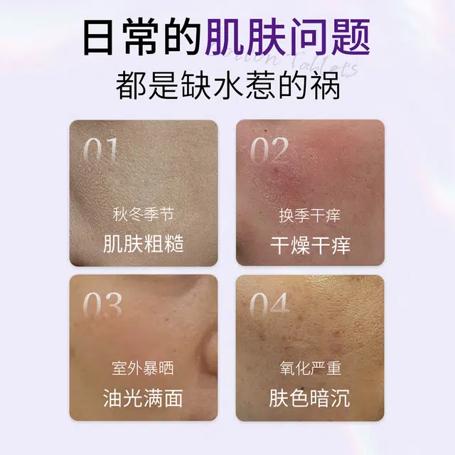 臻羞 臻羞紫苏果酸净透焕肤棉片补水嫩肤淡化 淡痘印祛痘 多种肤质