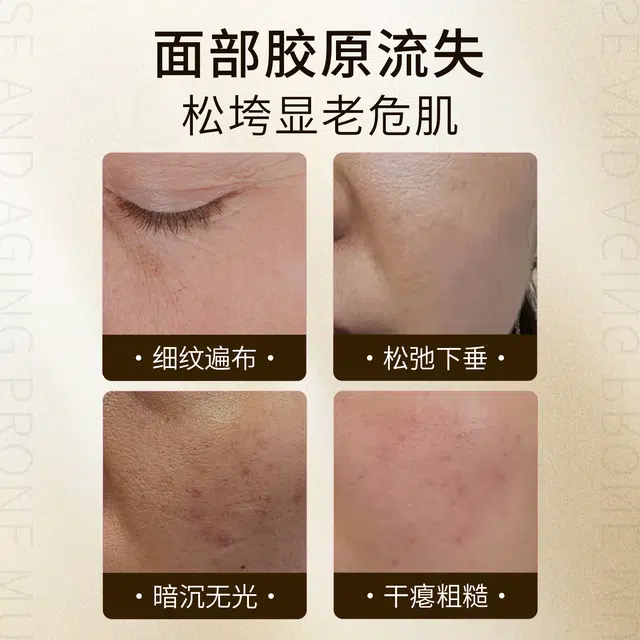 臻羞  臻羞帝皇蜂浆秘龄奇迹霜舒缓韧屏障亮泽柔嫩肌肤淡化细纹抗皱焕颜深层滋润持久保湿紧致提升 淡纹