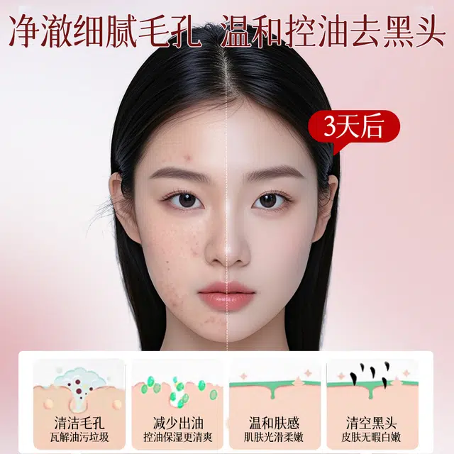 兰可欣 红石榴洁面乳 抗氧化控油清洁收缩毛孔