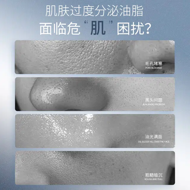 温碧泉 男士控油保湿爽肤水 补水保湿 清爽控油 改善干燥