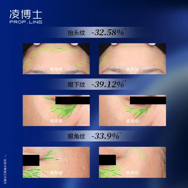 120ml+100g