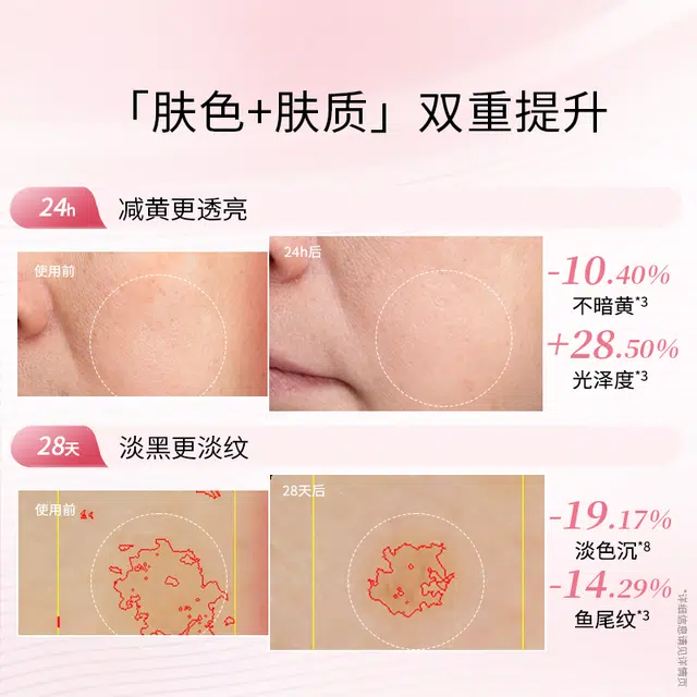 10ml+10g