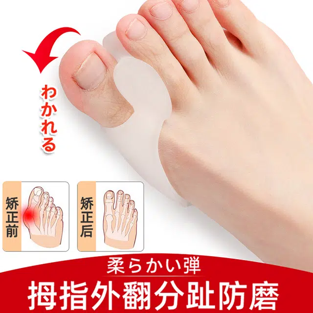 悦语 拇指外翻分扯 大单孔硅胶透气防磨脚趾矫正器