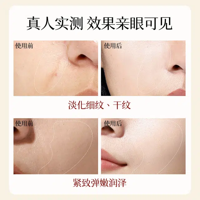 25ml*10
