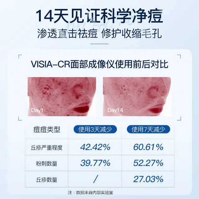 30ml